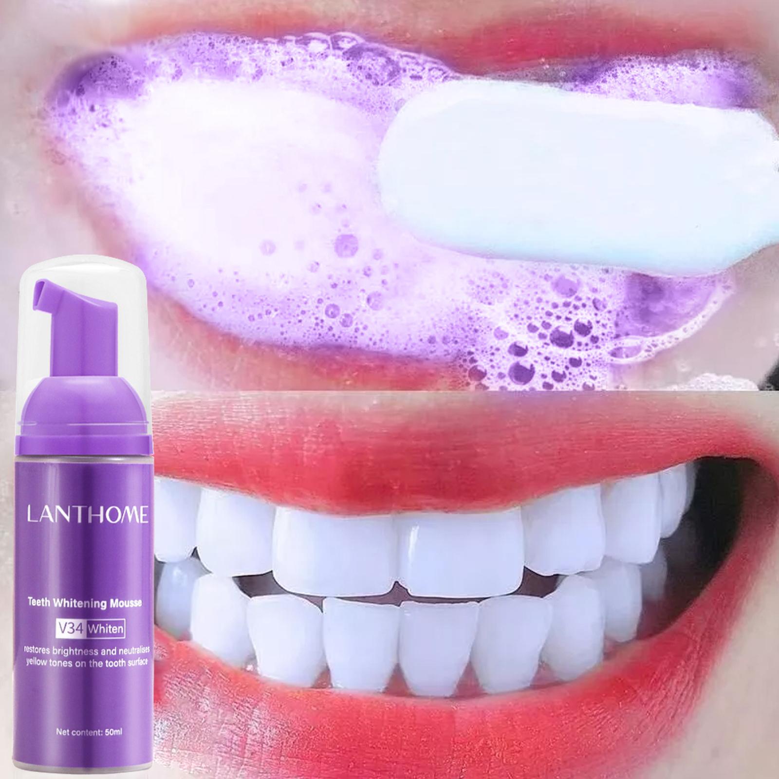 V34 Mousse Zahnreinigungs-Zahn – Teeth Whitening Yellow Teeth Bewertung und Preis