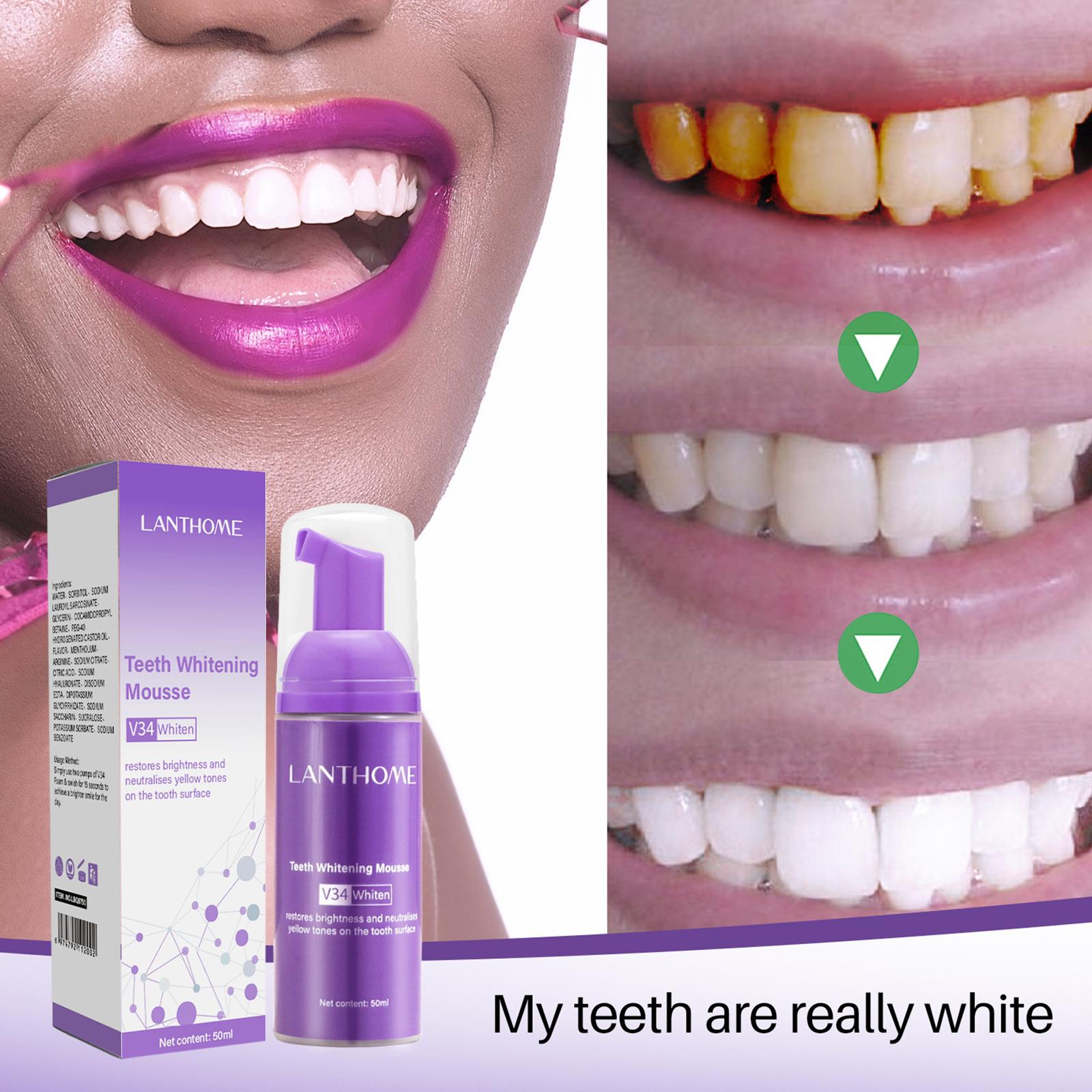 V34 Mousse Zahnreinigungs-Zahn – Teeth Whitening Yellow Teeth Bewertung und Preis