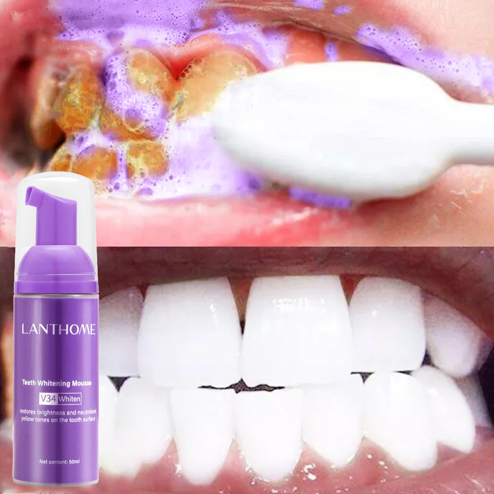 V34 Mousse Zahnreinigungs-Zahn – Teeth Whitening Yellow Teeth Bewertung und Preis