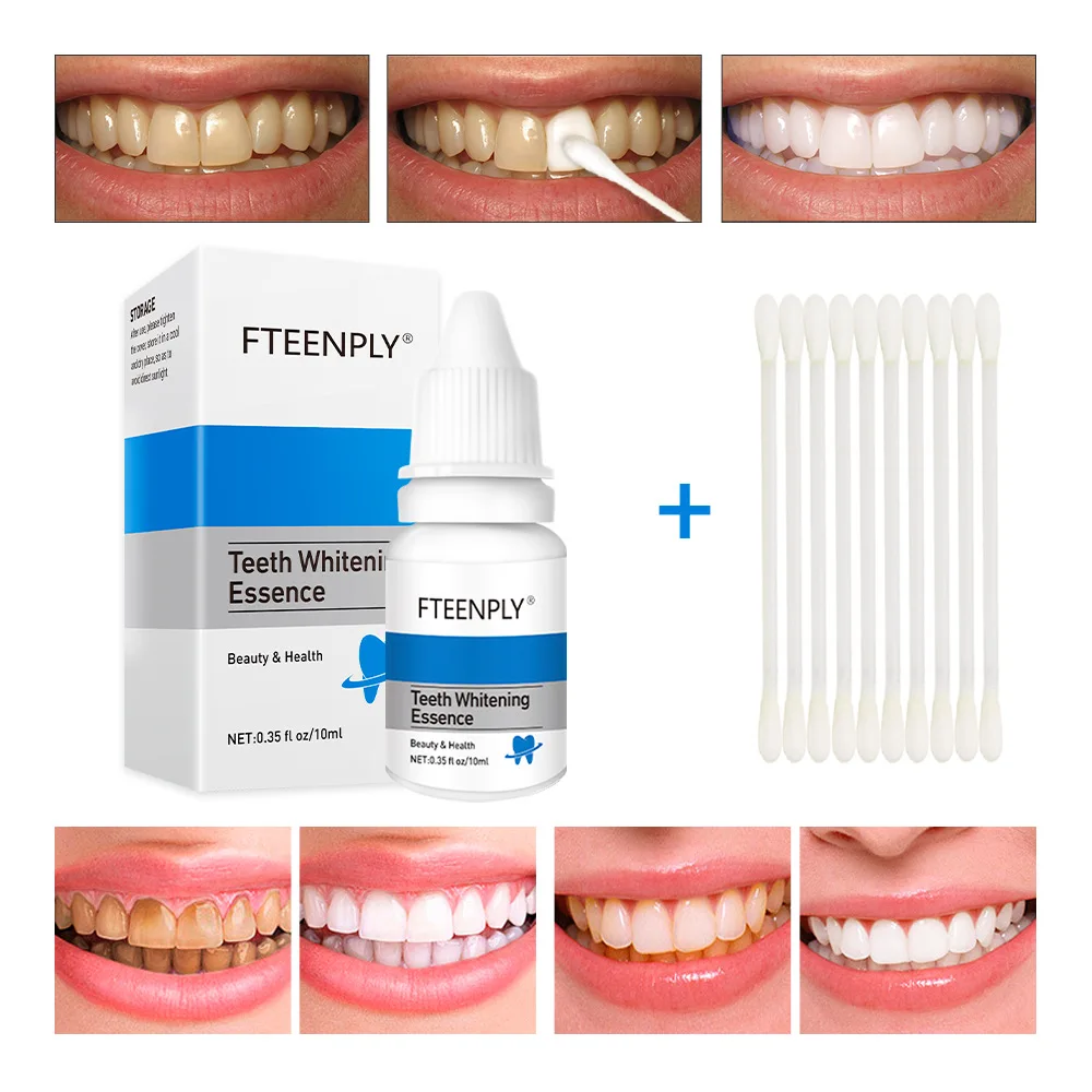 FTEENPLY Zahnaufhellung Essenz – Teeth Whitening Q&M Bewertung und Preis