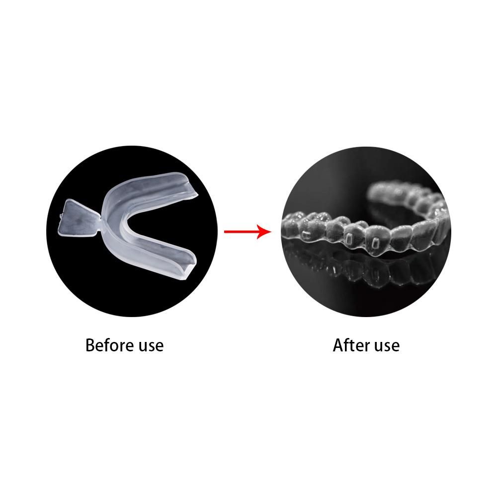 Schutz Bruxismus Zähne Abdecku – Teeth Whitening For Trays Bewertung und Preis