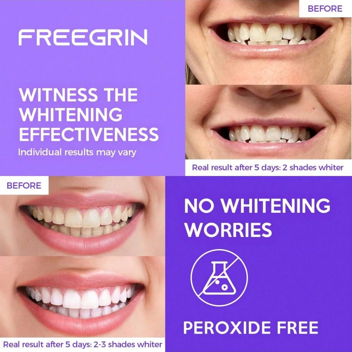 Deluxe Zahnaufhellungsaufklebe – Teeth Whitening Q&M Bewertung und Preis