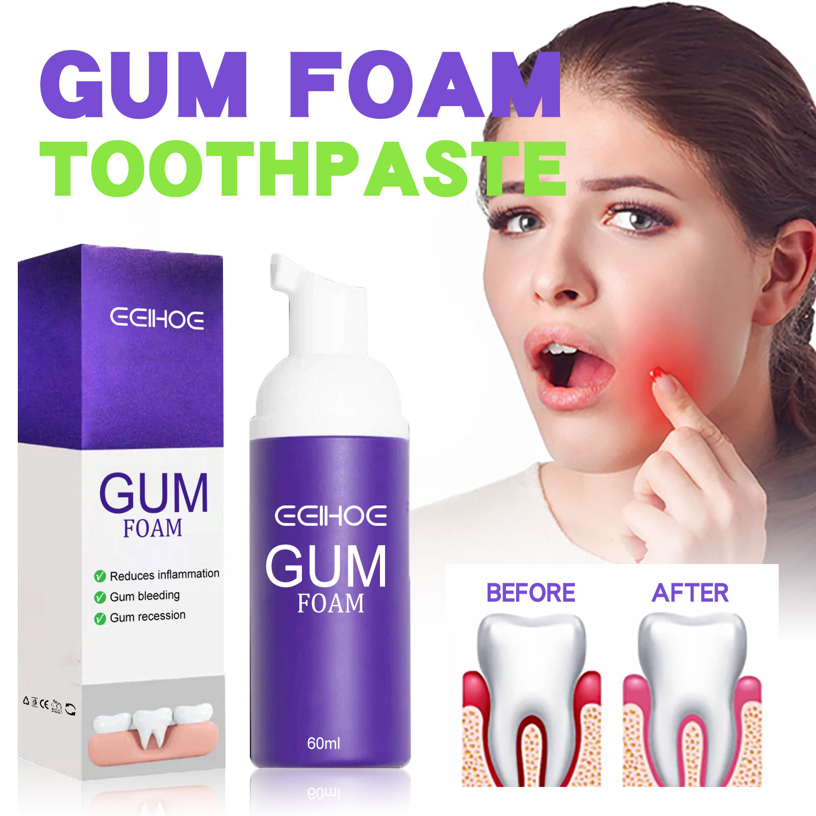 60 ml Zahnaufhellungsmousse V3 – Teeth Whitening Yellow Teeth Bewertung und Preis